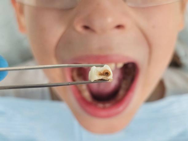 Best Same-Day Emergency Dental Services in Lake Waynoka, OH